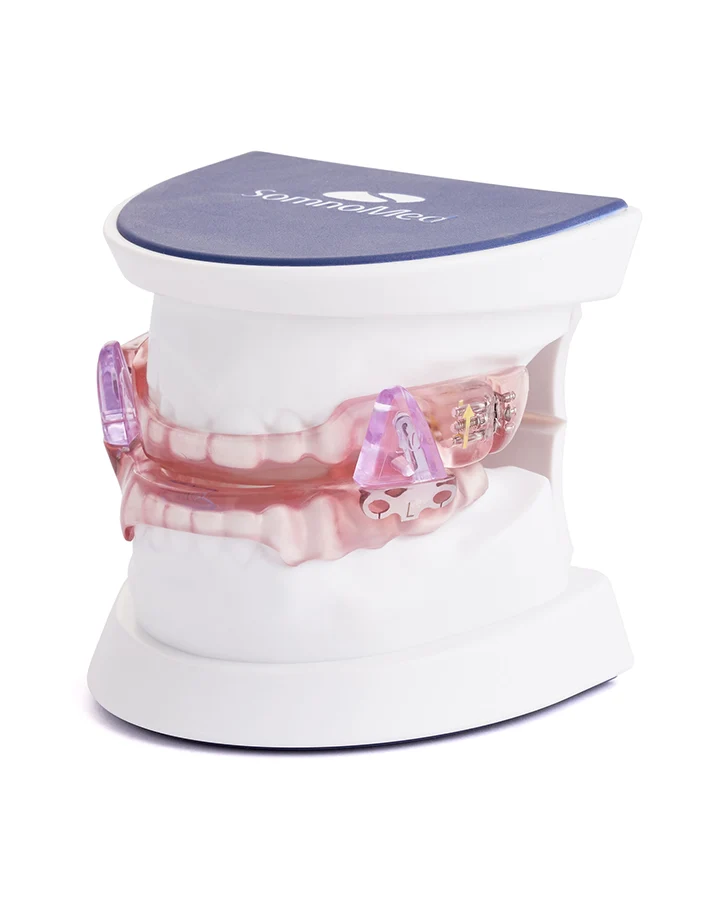 SomnoDent Fusion Pictures (LR), Am Kiefer Beispiel